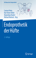 Endoprothetik Der Hüfte